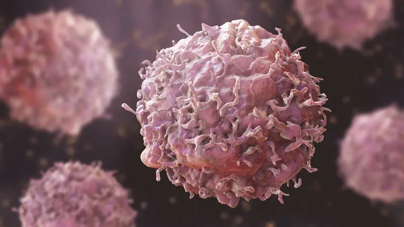 CANCER CASES PROJECTED TO RISE 67% BY 2050 — GLOBOCAN